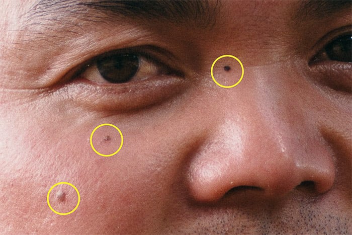A screenshot of how to remove skin imperfections with Photoshop 