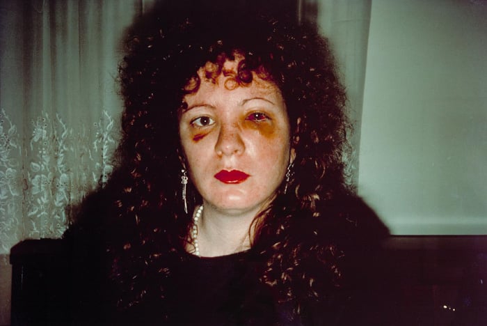 Nan one month after being battered&nbsp;- Nan Goldin (1984)&nbsp;- controversial photos